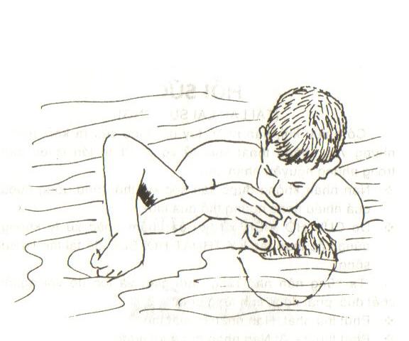 Hô hấp nhân tạo (1)